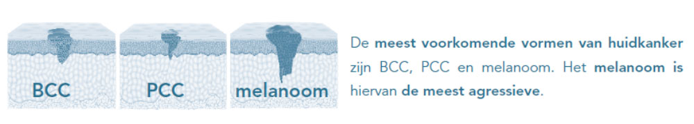 Voorkomende Soorten Van Huidkanker