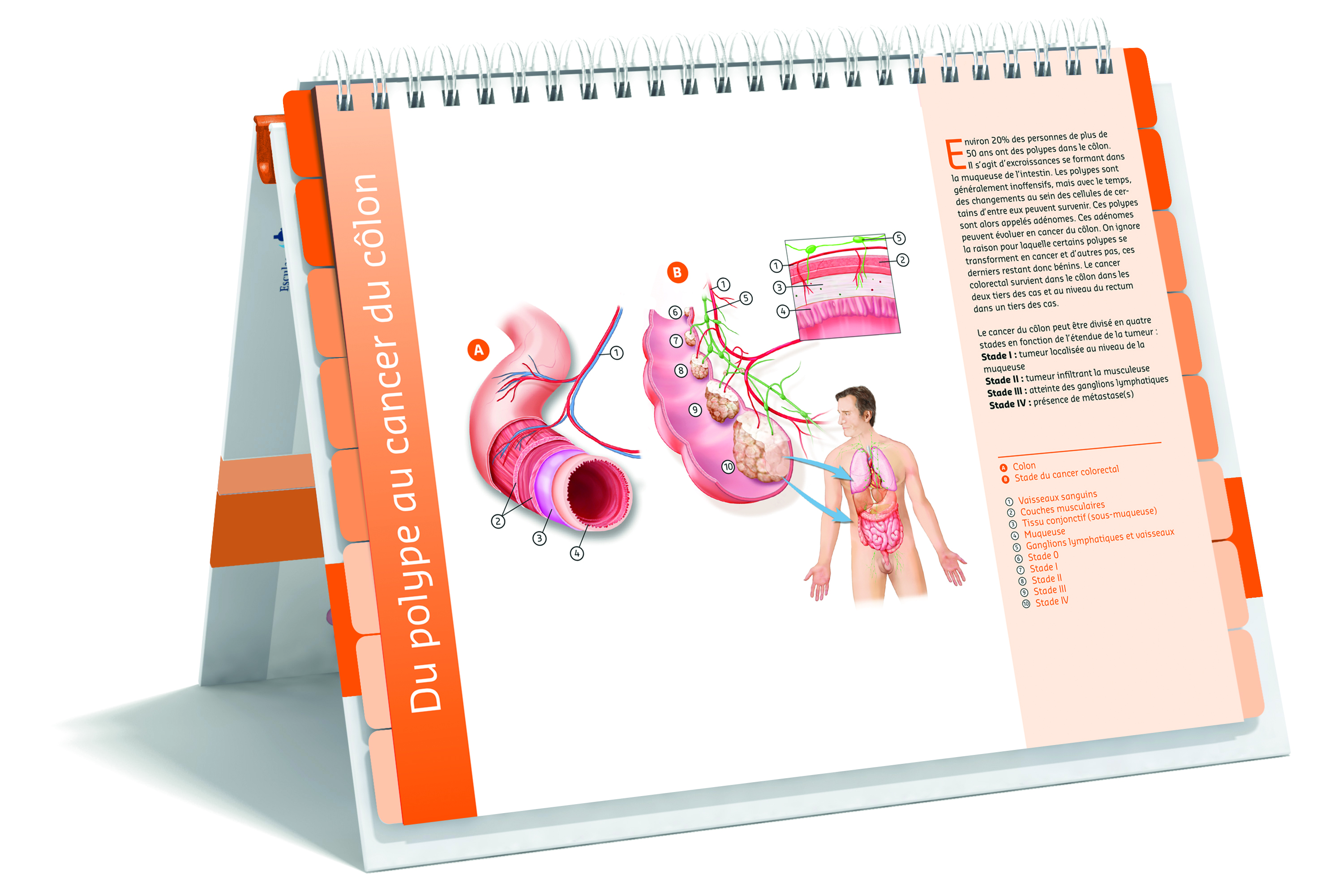 Atlas de soins du cancer colorectal
