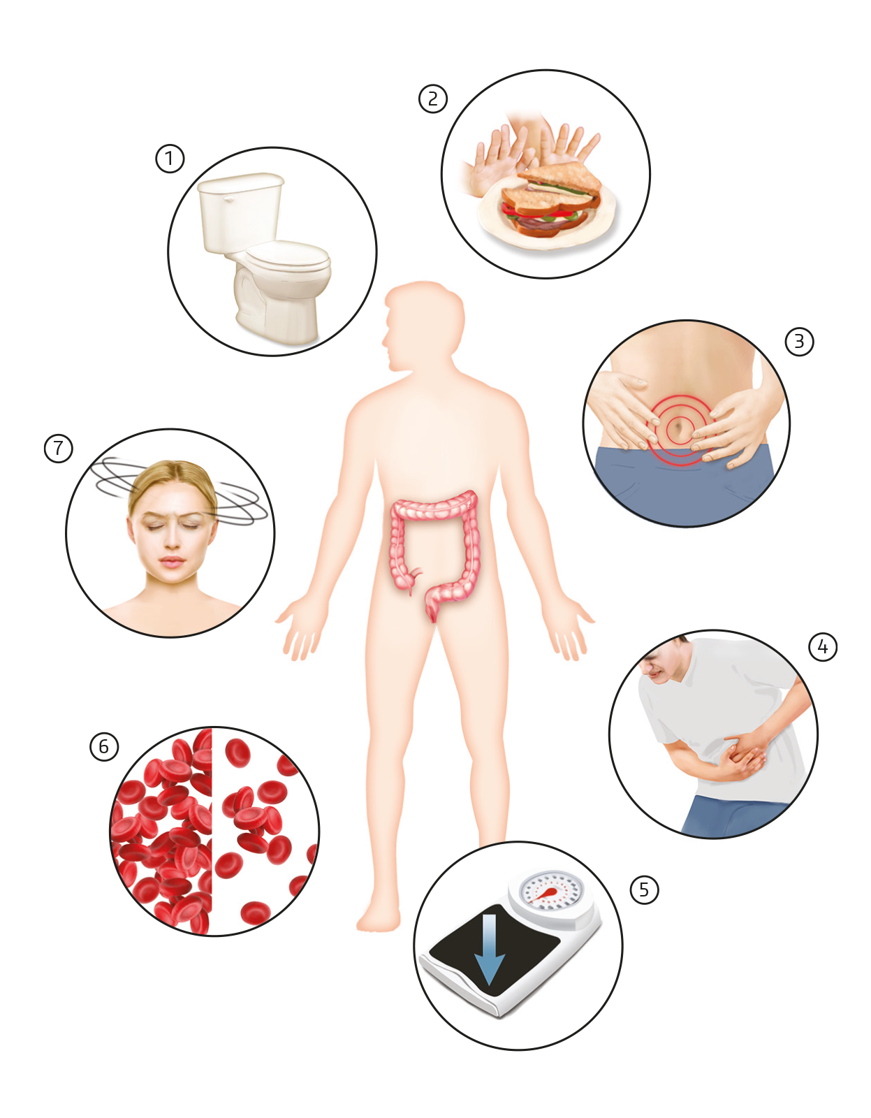 Symptômes du cancer colorectal
